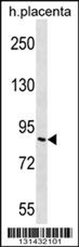 GP111 Antibody (Center)