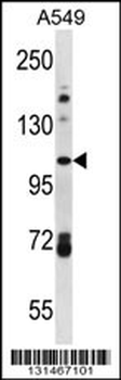 FA13B Antibody (Center)