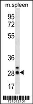 CIB4 Antibody (N-term)