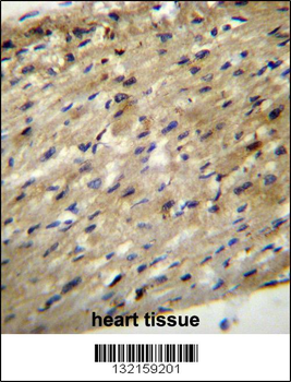 ABCD2 Antibody (C-term)