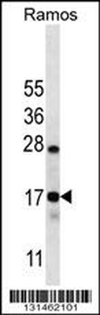 CO040 Antibody (C-term)