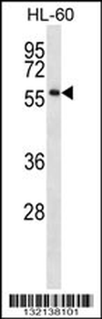 ONECUT1 Antibody (C-term)