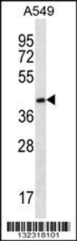 FBLIM1 Antibody (C-term)