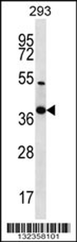 NKX2-2 Antibody (Center)