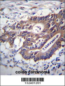 KRT12 Antibody (C-term)