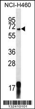 GPSM1 Antibody (Center)