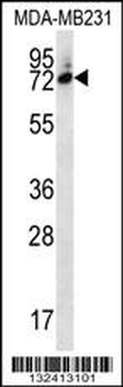 SIX5 Antibody (Center)