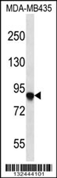 AFAP1 Antibody (C-term)