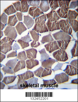 NPHP3 Antibody (N-term)