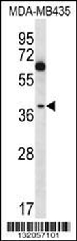 NFKBIL1 Antibody (C-term)