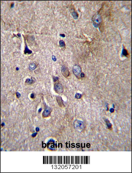 NFKBIL1 Antibody (C-term)