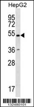 RNF38 Antibody (N-term)