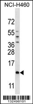 SMCP Antibody (C-term)