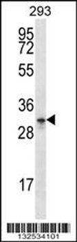GPM6A Antibody (C-term)