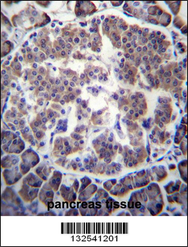 TBL2 Antibody (N-term)