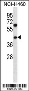 PUS1 Antibody (C-term)