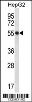 HEPACAM Antibody (C-term)