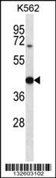 OXA1L Antibody (C-term)