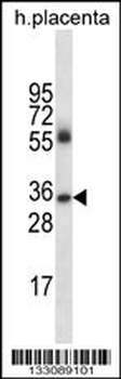 IGHG4 Antibody (Center)