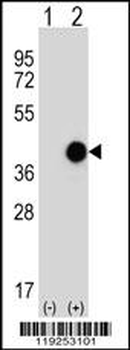 CTSK Antibody (Center E112)