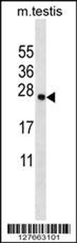 TMM18 Antibody (Center)