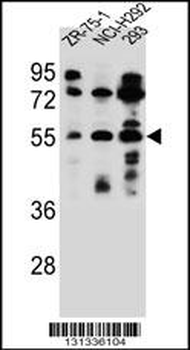 FUT6 Antibody (N-term)