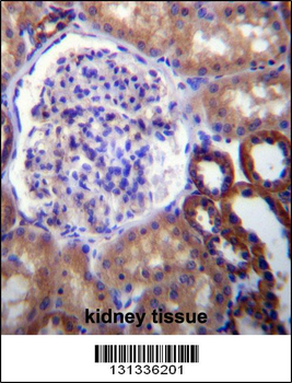 FUT6 Antibody (N-term)