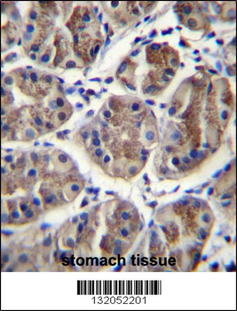 EIF3A Antibody (C-term)