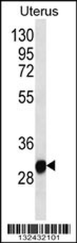 RNF148 Antibody (C-term)