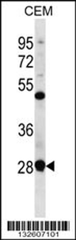 RRP7A Antibody (C-term)