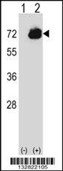 CTPS2 Antibody (C-term)