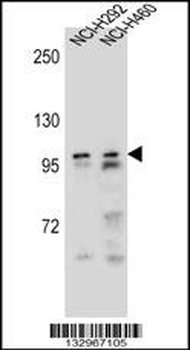 AR Antibody (Center)