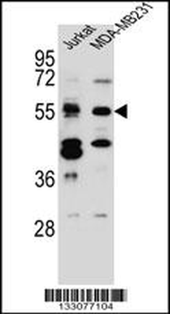 TNRC4 Antibody (N-term)