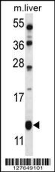 GOT1B Antibody (C-term)