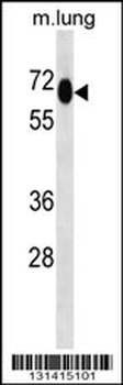 MEPCE Antibody (Center)