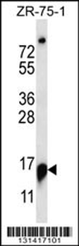 RPP25 Antibody (C-term)