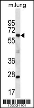 SP2 Antibody (C-term)