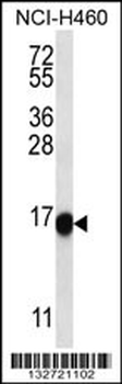 CX001 Antibody (C-term)