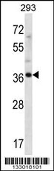 ANKRD60 Antibody (C-term)