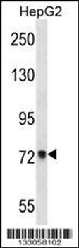 ACSS2 Antibody (Center)