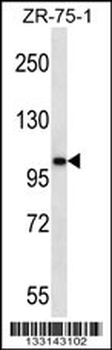 AR Antibody (Center)