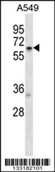 TCP11L2 Antibody (N-term)