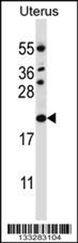 CDKN1B Antibody (C-term)