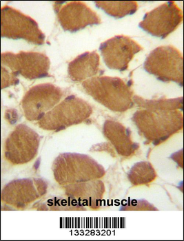 CDKN1B Antibody (C-term)