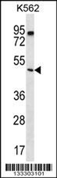 PTEN Antibody (C-term)