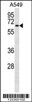 TM9SF1 Antibody (N-term)