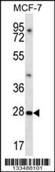 PDCL3 Antibody (N-term)