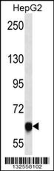 MAGED4B Antibody (Center)