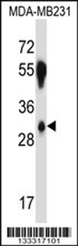 SFRS2B Antibody (N-term )
