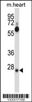 SFRS2B Antibody (N-term )